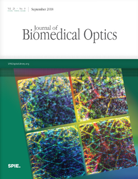 Wideband linear detector arrays for optoacoustic imaging based on polyvinylidene difluoride